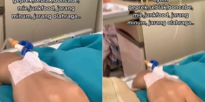 Rekomendasi Olahraga Yang Aman Setelah Operasi Usus Buntu