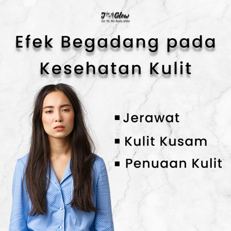 Begadang Berdampak Pada Jerawat: Mitos Atau Fakta?